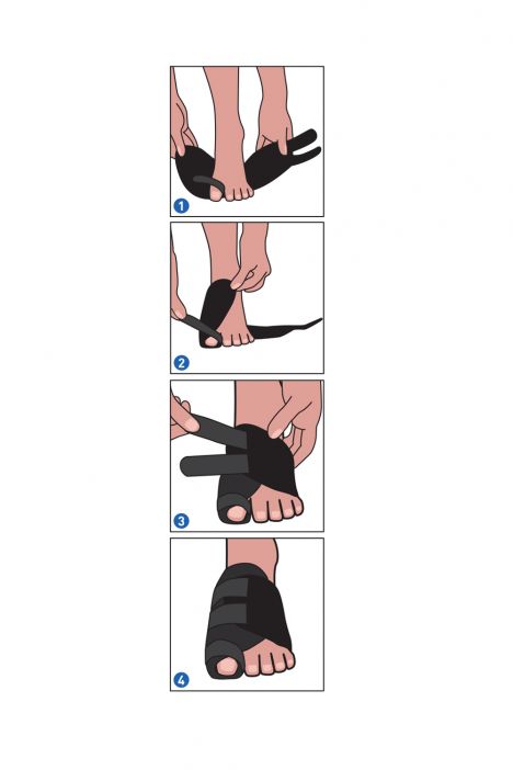 Kifidis Halluks Valgus Soft Bandaj SAG